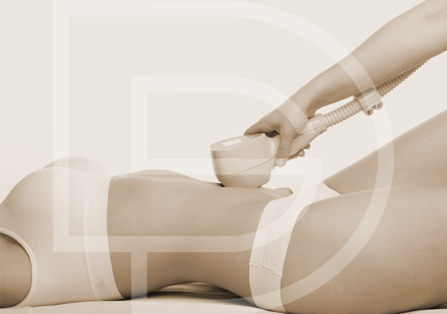 Soin radiofréquence Exilis à Montpellier