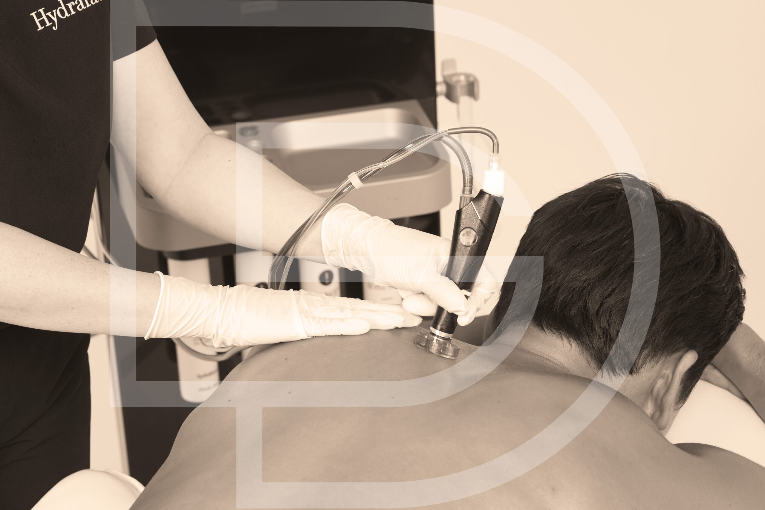 Hydrafacial corps (dos) à Montpellier